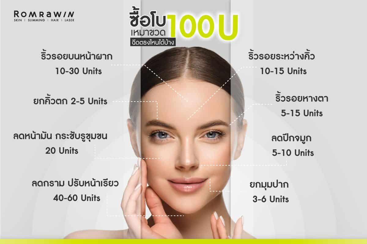 รีวิวฉีดโบท็อกลดริ้วรอย