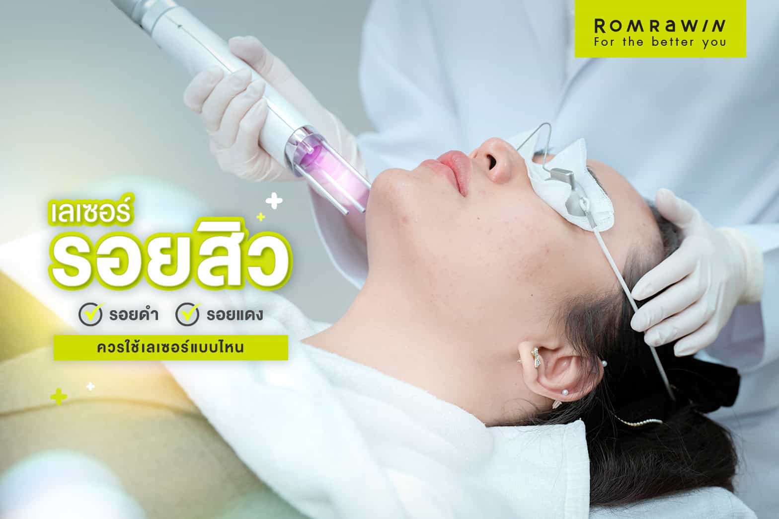 เลเซอร์รอยสิว