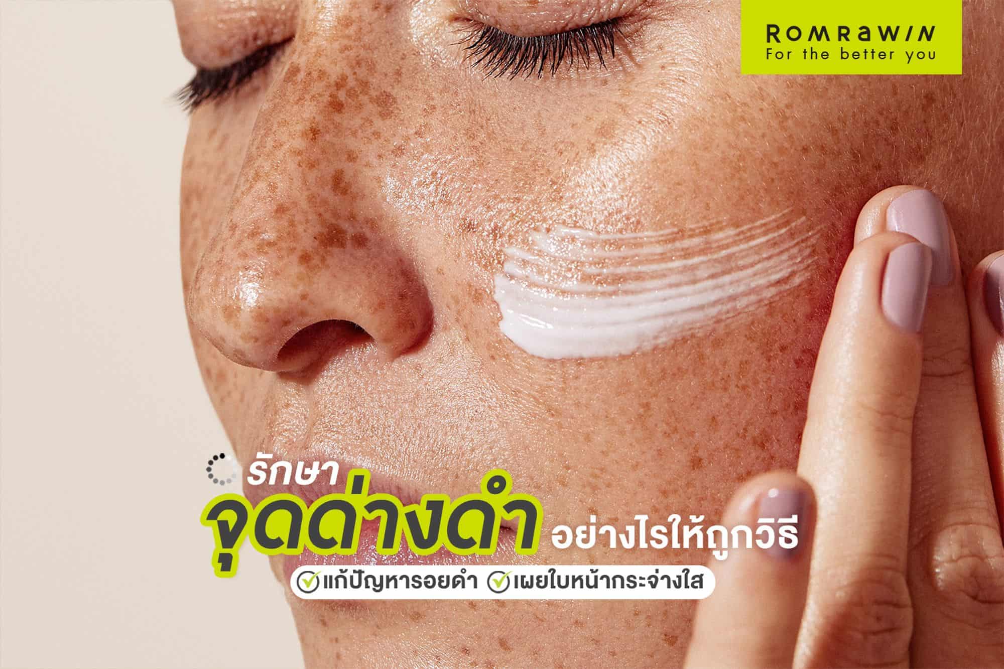 จุดด่างดำ
