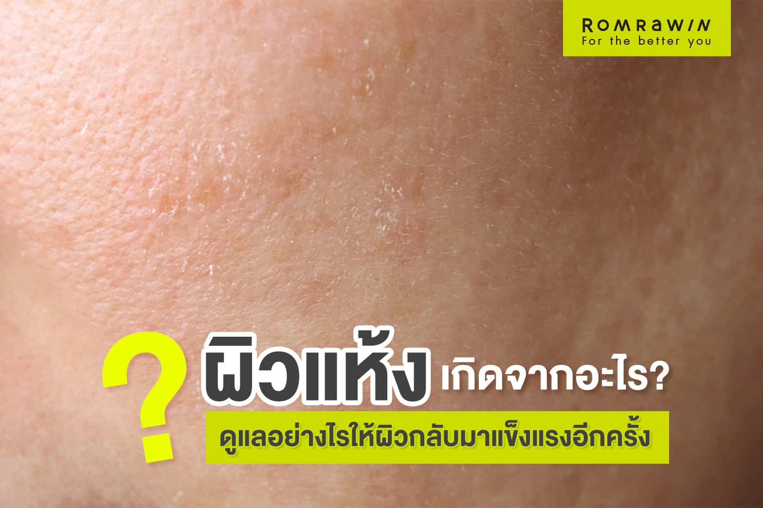 ผิวแห้ง