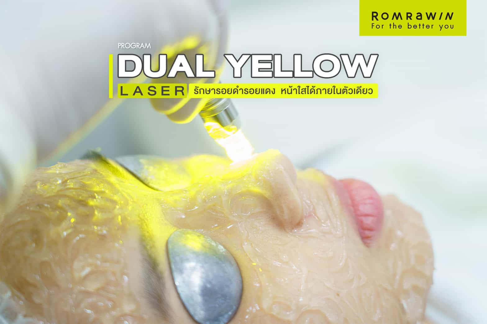 dual yellow laser คืออะไร