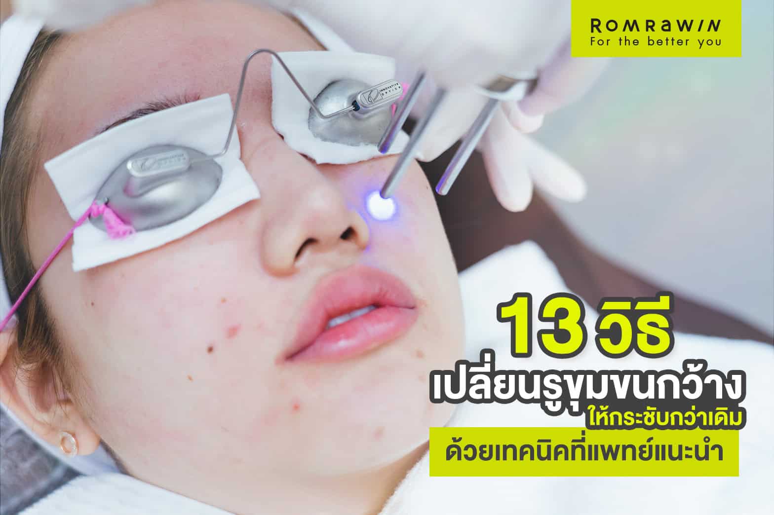 รูขุมขนกว้าง