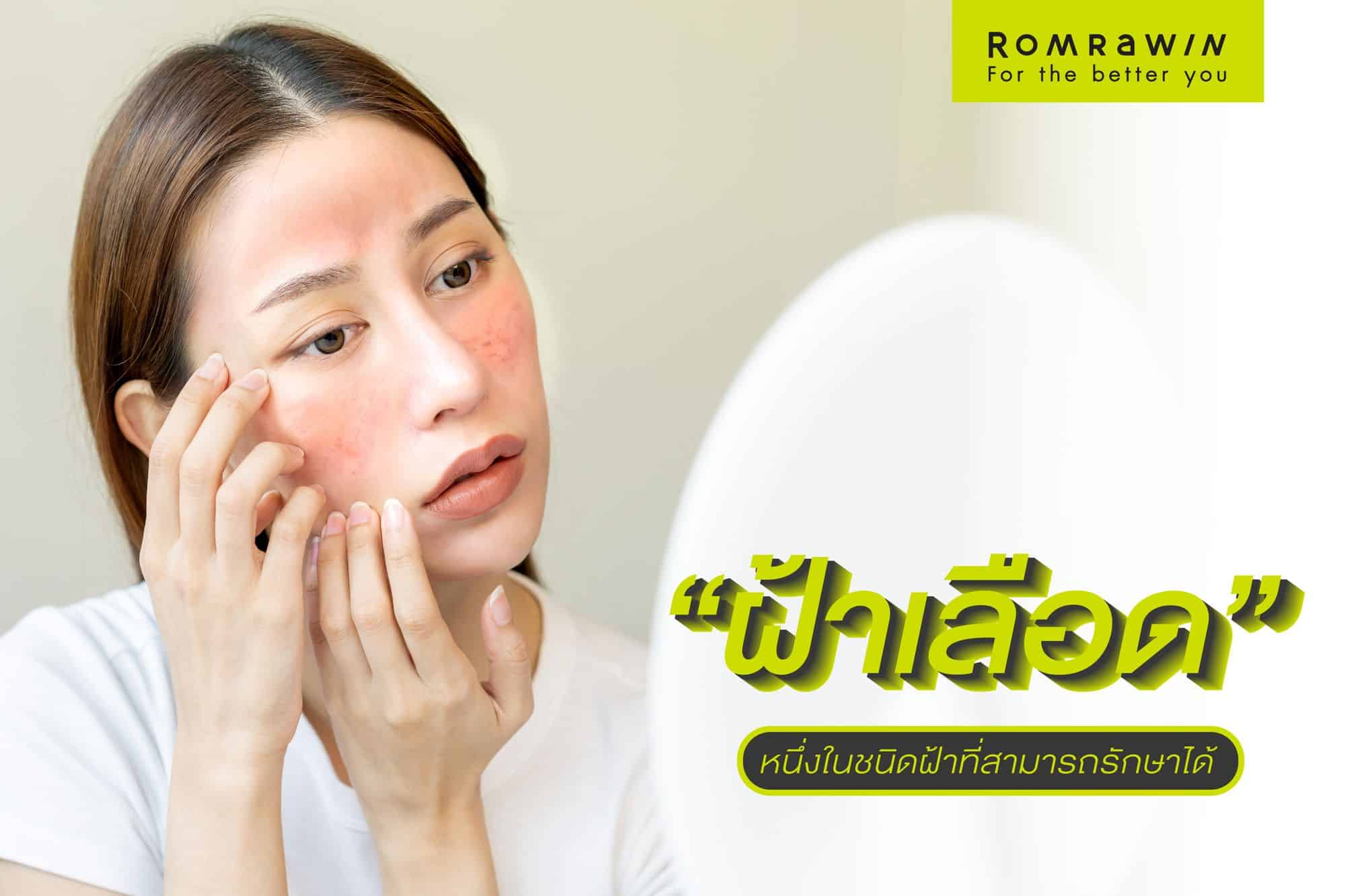 ฝ้าเลือด