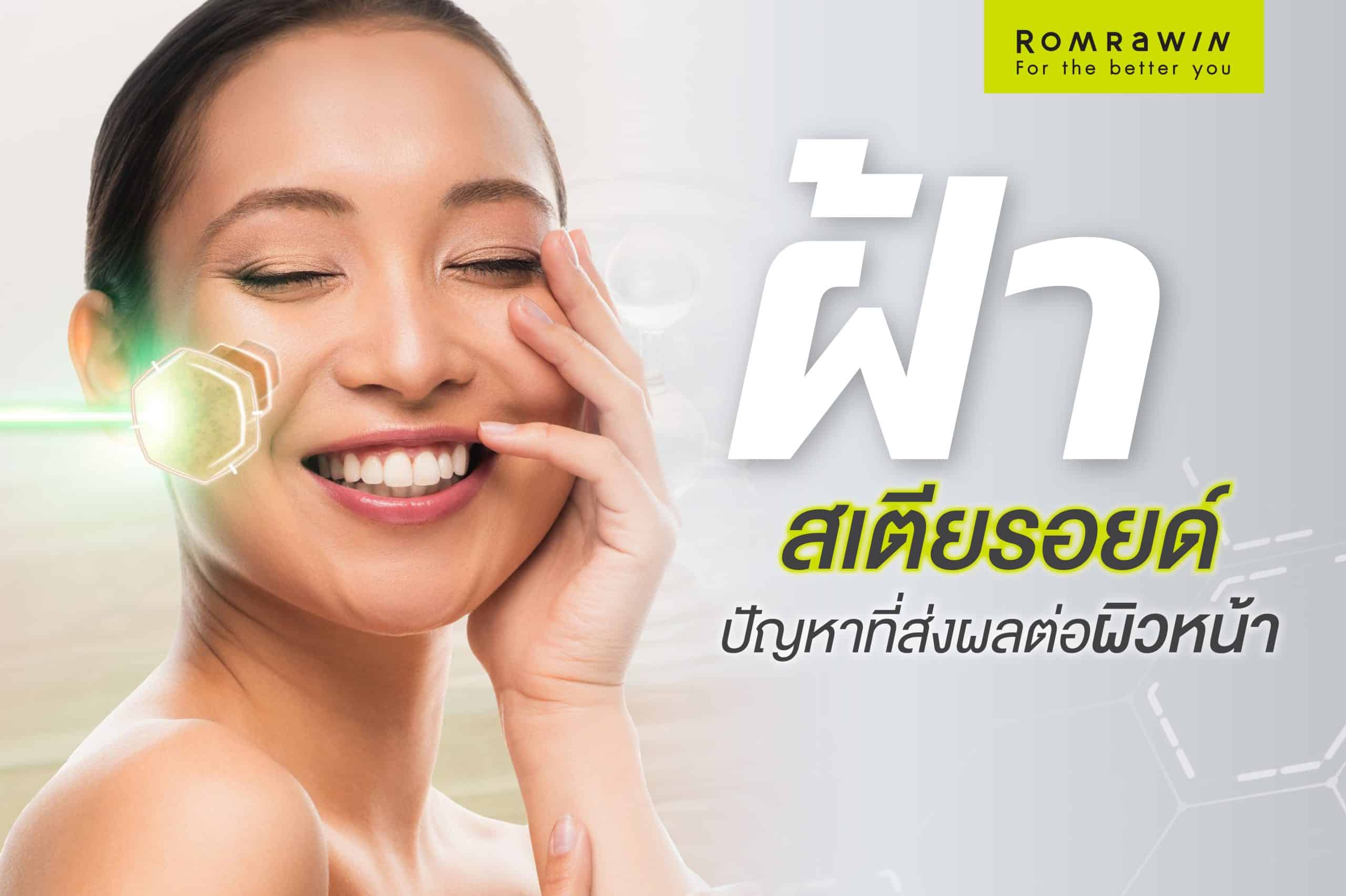 ฝ้าสเตียรอยด์