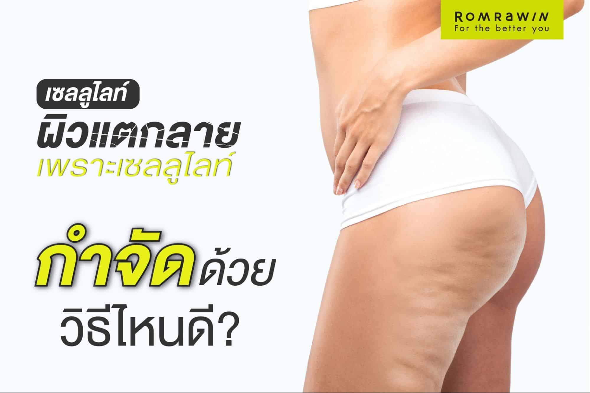 เซลลูไลท์