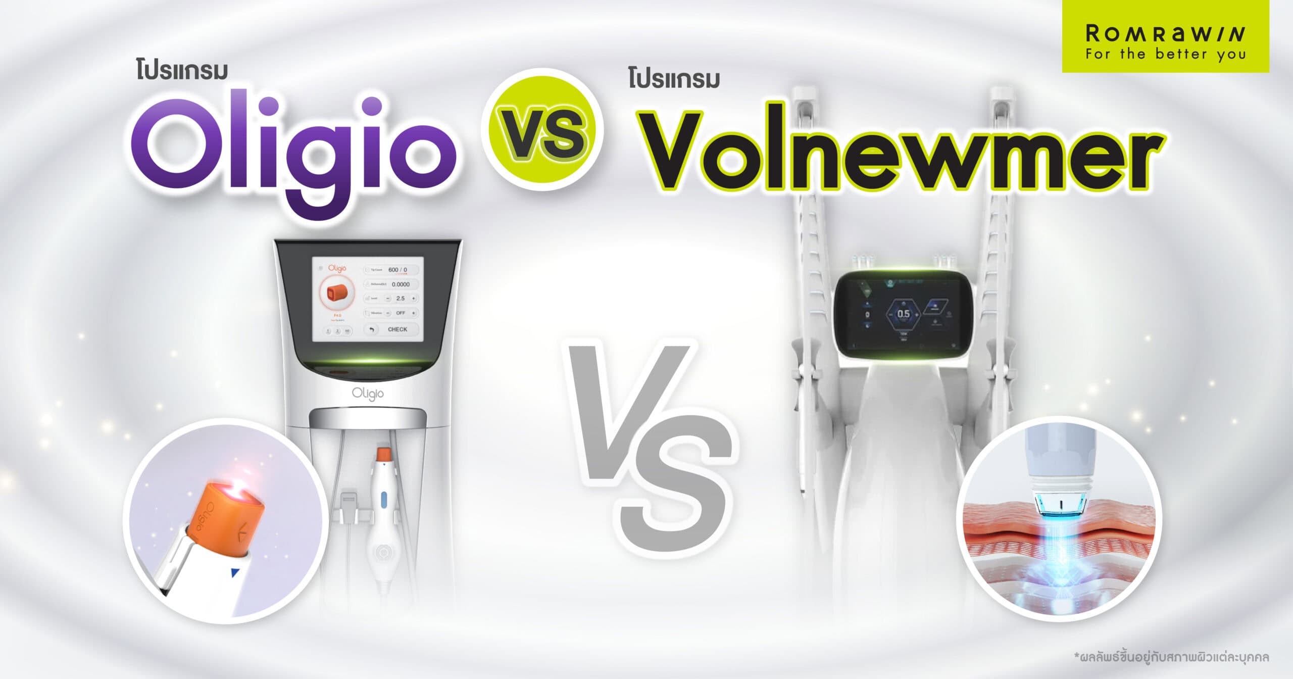 Oligio และ Volnewmer